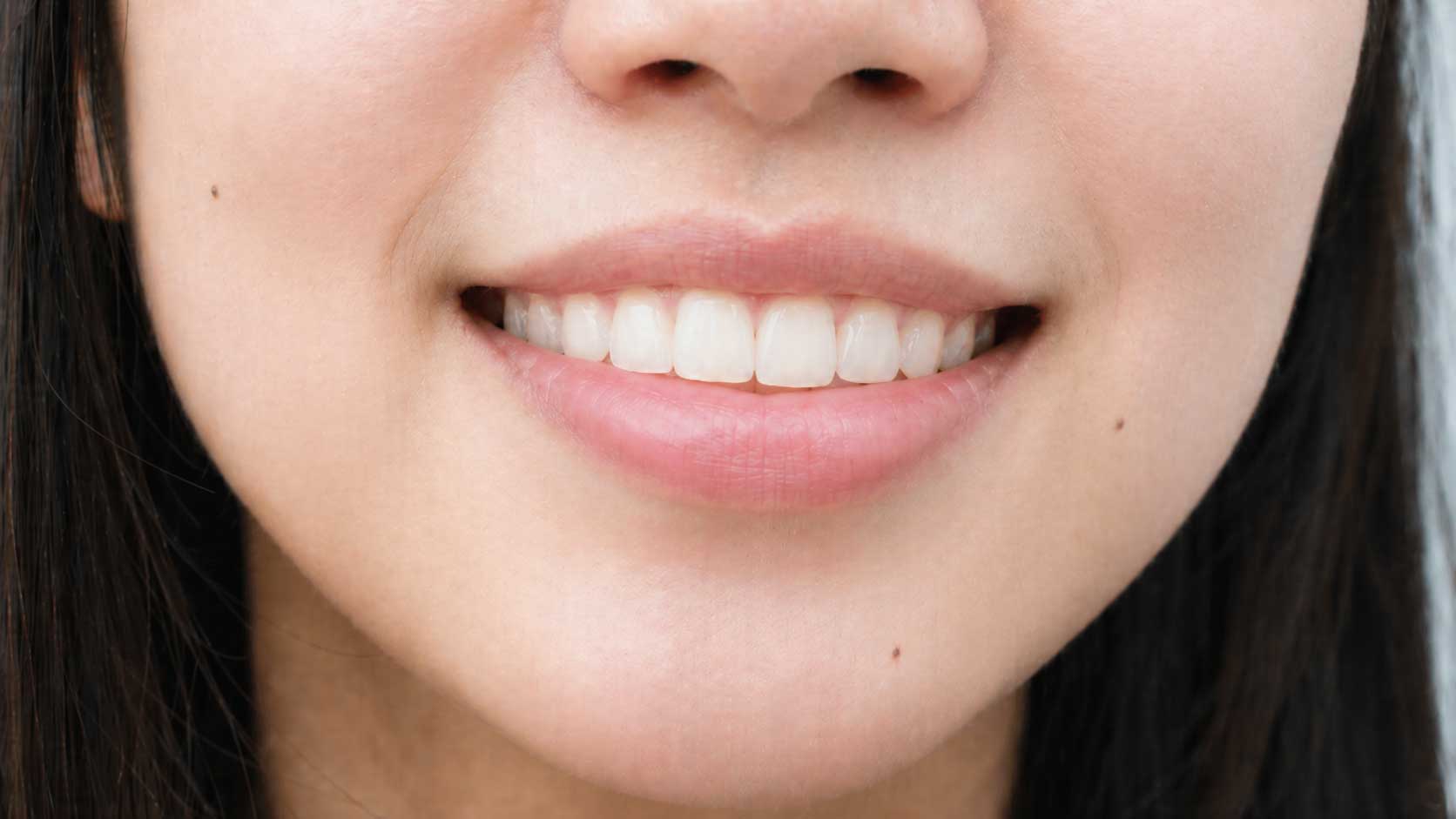 矯正後の歯並び